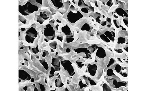 Scanning electron microscope (SEM) image of Durapore® PVDF membrane filters