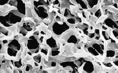 Scanning electron microscope (SEM) image of Durapore® PVDF membrane filters