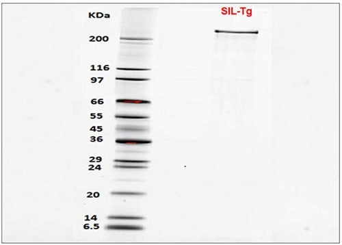 SDS-PAGE of SIL-Thyroglobulin showing purity >95%.  Samples were first reduced using 2X Laemmli Sample Buffer (Prod. No. S3401).  250 ng sample was then loaded on gel, along with molecular weight marker SigmaMarker (Prod. No. S8445).  After electrophoresis, gel was stained using SYPRO Ruby gel stain (Prod. No. S4942) before visualization.