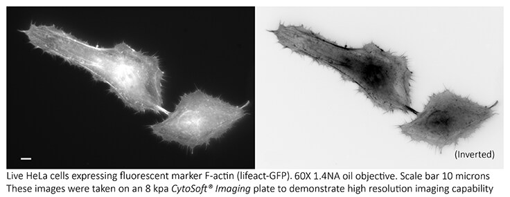 Cell migration and adhesion can be analyzed by monitoring the expression of F-actin filamentous cytoskeleton protein. Fluorescent cell imaging of F-actin in HeLa cells using CytoSoft® imaging plates (8 kPA). Cell migration and adhesion can be analyzed by monitoring the expression of F-actin filamentous cytoskeleton protein.