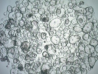 Human colon organoids