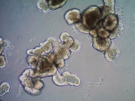 Mouse intestinal organoid.