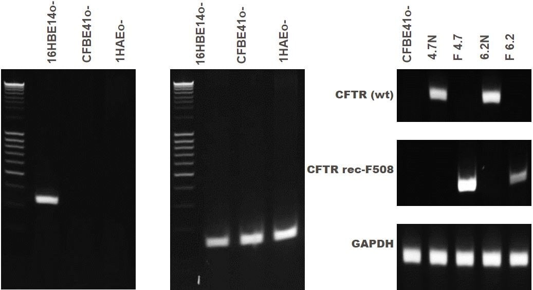 CFTR gene expression of bronchial epithelial cell lines.