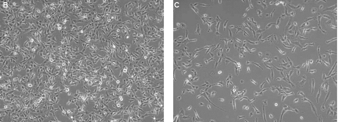 HT1080 cells on day three after subculture (P7) are shown in the Cancer Cell Line Medium XF (<b>B</b>) and conventional FBS containing culture conditions (<b>C</b>) (100x magnification). Morphology of HT1080 fibrosarcoma cells cultured in Cancer Cell Line Medium XF compared toconventional FBS containing culture conditions