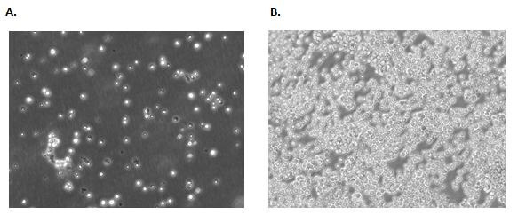 Examples of a suspension cell line. <a href="/product/sigma/cb_88042803">Jurkat E6.1</a> cells 24 hours (A) and 72 hours (B) post freeze/thaw show typical suspension lymphoblastic morphology. Confluence should carefully be monitored and passaged when cells reach ~80% confluency. suspension cell line