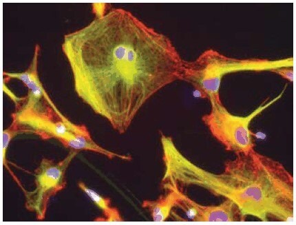 Neural stem cell differentiation