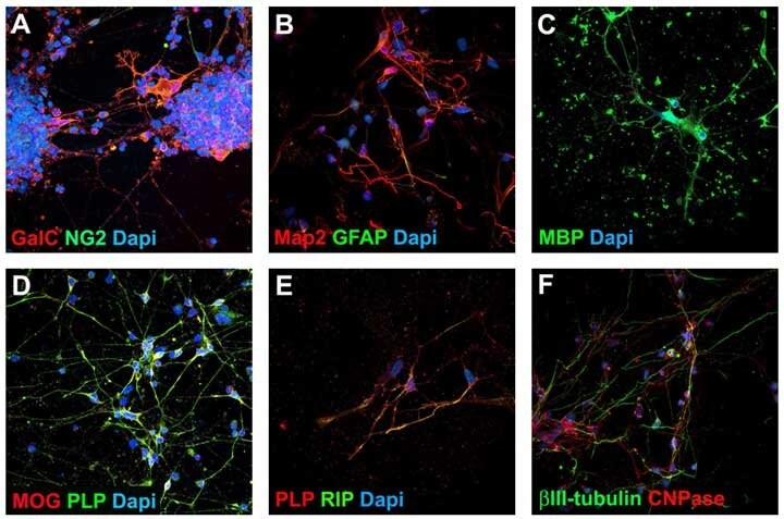 Mature Oligodendrocyte Characterization. After 2 weeks of spontaneous differentiation, Human OPCs generate approximately 30% mature oligodendrocytes (MBP, MOG, PLP, RLP, RIP) and ~50% neurons (Tubulin, MAP2). Human OPCs were plated at 10<sup>4</sup> cells/cm<sup>2</sup> onto poly-L-ornithine and laminin coated 24 well plates in Human OPC Expansion Complete Media. Twenty-four hours post-seeding, spontaneous differentiation was initiated by media exchange with Human OPC Spontaneous Differentiation Complete Media. Oligodendrocyte Progenitor Cell Characterization