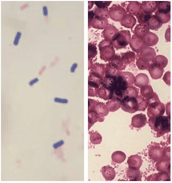 Gram staining (on the left Gram-positive Bacilus cereus, on the right Gram-negative Citrobacter).