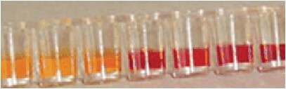 ß- Lactamase Test kit (positive reaction is shown by a color change to yellow)