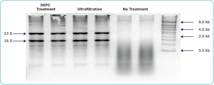 Gel electrophoresis of rRNA in water previously spiked with RNase and either DEPC-treated, ultrafiltered, or left untreated