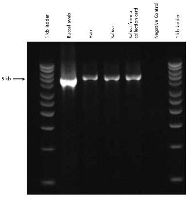 PCR analysis of genomic DNA extracted from various types of human tissue and amplified with 5 kb β-Globin primers