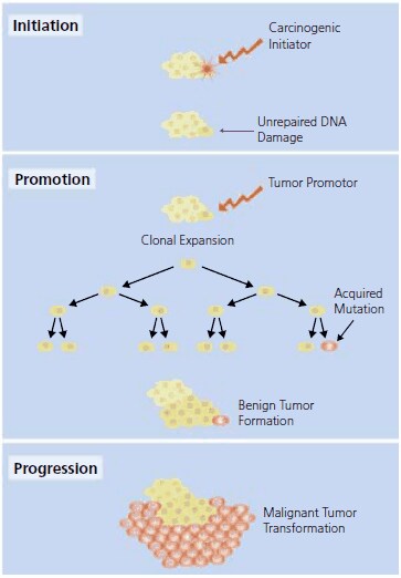 The classical model of carcinogensis proceedes from initiation to promotion and then evolves to progression. See text for further description. The classical model of carcinogensis proceedes from initiation to promotion and then evolves to progression. See text for further description.