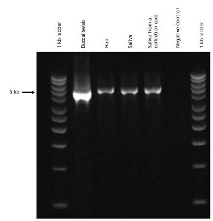 PCR analysis of genomic DNA extracted from various types of human tissue and amplified