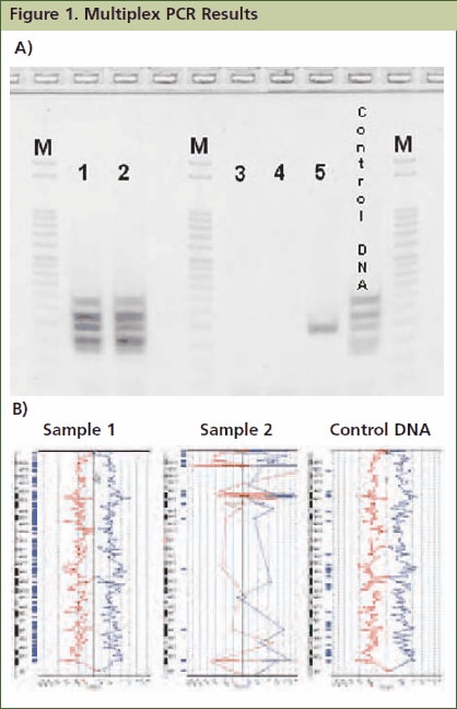 Approximately 1mg of tissue was collected from five FFPE tissue samples followed by processing with the GenomePlex Tissue Whole Genome Amplification Kit (Product No. WGA2) as outlined in the technical bulletin. (A) 5 μL of undiluted WGA2 tissue lysate was subjected to multiplex PCR amplification as outlined below, and 5 μL of each reaction was resolved on a 4% agarose gel (Invitrogen # G6000-04). The 100 bp DNA ladder (Invitrogen catalog # 15628-019) was used as a size standard. All five bands were amplified in lanes 1 and 2 indicating that these FFPE tissue lysates contain high quality genomic DNA, whereas lanes 3, 4 and 5 contain low quality DNA since all, or most, of the multiplex PCR fragments were not amplifiable. Similar results were observed when purified DNA or amplified WGA product derived from these FFPE tissues were used directly in the multiplex qPCR assay (data not shown). (B) aCGH was performed to demonstrate a correlation between the multiplex PCR results and aCGH performance. 1 μg of WGA2 products were used for BAC aCGH analysis using PerkinElmer’s Spectral Labeling Kit and SpectralChip™ 2600 array platform per manufacturer’s recommendations. The ideograms below are representative of the data obtained with this sample set. They were generated using PerkinElmer’s Spectralware™ BAC array analysis software. High quality array statistics and QC metrics were obtained with samples 1 and 2, where as samples 3, 4 and 5 produced irregular array statistics and poor QC metrics. Test and control hybridization samples are labeled in Figure B.