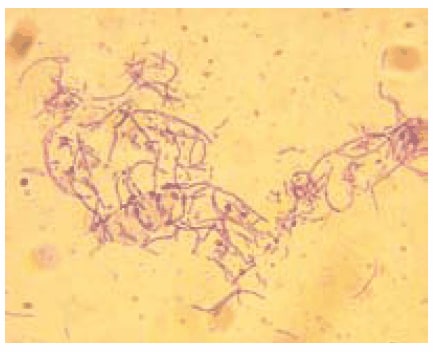 Microscopic picture from Bacillus anthracis