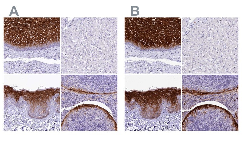Immunohistochemical staining of human esophagus, liver, skin, and tonsil using Anti-A2ML1 antibody HPA038847 (A) shows similar protein distribution across tissue to independent antibody HPA038848 (B).