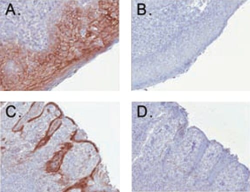 Enhanced Antibody Validation for Immunohistochemistry using anti-desmoglein in human tonsil tissue.