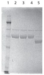 Lanes of SDS-PAGE separation analyzing native and PNGase F-treated α-1 antitrypsin (AAT), with the test sample being deglycosylated in solution with PNGase F.