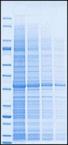 mPAGE<sup>®</sup> Precast Gel <br> 35-minute run time mPAGE® Precast Gel 35-minute run time