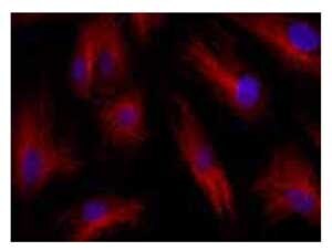 Immunofluorescence of HUVEC cells using TALDO1 (31-45)
