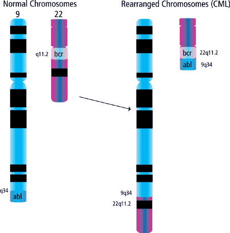 Generation of the Philadelphia chromosome observed in >95% of chronic myelogenous leukemias (CML).