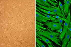 Human Follicle Dermal Papilla Cells (HFDPC) Human Follicle Dermal Papilla Cells (HFDPC)