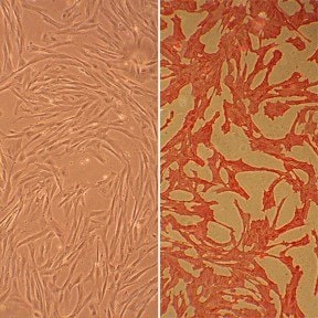 Canine Aortic Smooth Muscle Cells (CnAOSMC)