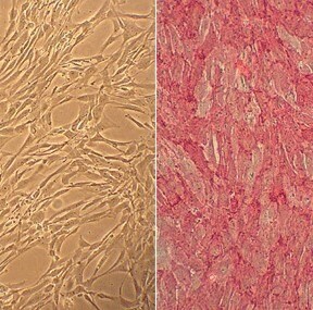 Human Brachiocephalic Artery Smooth Muscle Cells (HBcASMC)