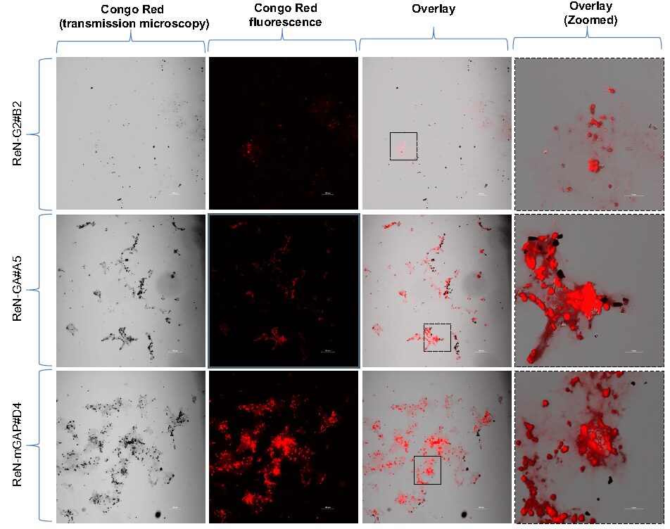 Clonal FAD ReNcell NSCs (SCC008FAD2, SCC008FAD3, SCC008FAD5) were 3D differentiated for 7 weeks and extracted with mild detergent. The pellet (insoluble) fractions were resuspended in PBS, loaded and fixed in glass slides and stained with 1% Congo red solution (HT60). culture by Congo red staining