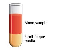 Blood sample layered onto Ficoll-Paque media