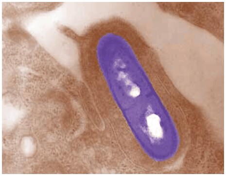 Electron micrograph of a Listeria monocytogenes bacterium in tissue