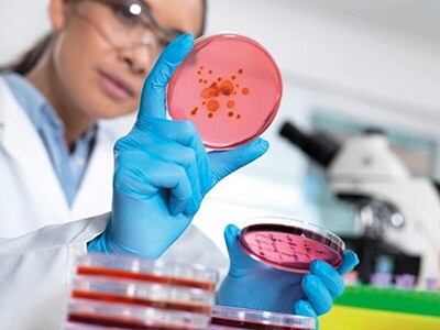 Microbiological culture media is used to test for contamination of food and water