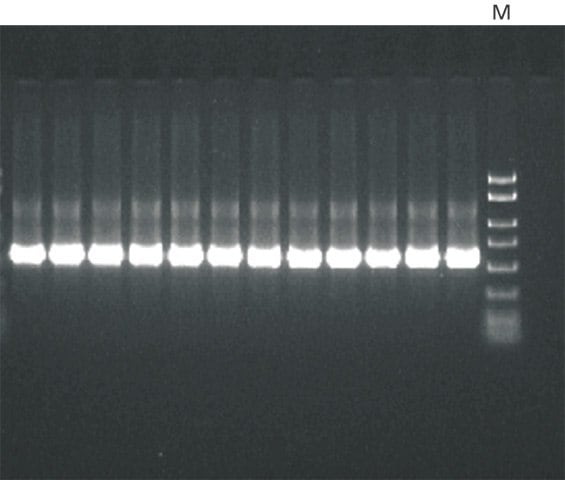 PCR amplification 