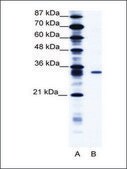 Anti-KCNIP4 antibody produced in rabbit affinity isolated antibody