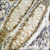 Anti-phospho-MEF2A (pThr312) antibody produced in rabbit affinity isolated antibody