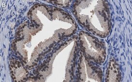 Anti-PRMT5 Antibody, clone 1H16 ZooMAb® Rabbit Monoclonal recombinant, expressed in HEK 293 cells