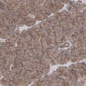 Anti-SCRIB antibody produced in rabbit Prestige Antibodies® Powered by Atlas Antibodies, affinity isolated antibody, buffered aqueous glycerol solution
