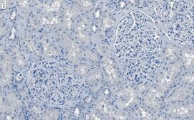 Anti-Rab7A Antibody, clone 4E15 ZooMAb® Rabbit Monoclonal recombinant, expressed in HEK 293 cells