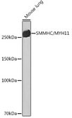 Anti-SMMHC/MYH11 Antibody, clone 0O4O4, Rabbit Monoclonal