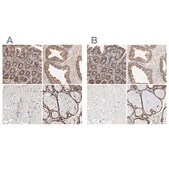 Anti-PDIA3 antibody produced in rabbit Ab1, Prestige Antibodies® Powered by Atlas Antibodies, affinity isolated antibody, buffered aqueous glycerol solution