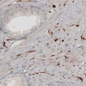 Monoclonal Anti-UCHL1 antibody produced in mouse Prestige Antibodies® Powered by Atlas Antibodies, clone CL3210, purified immunoglobulin, buffered aqueous glycerol solution