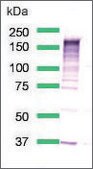 Anti-EGFR antibody, Rabbit monoclonal clone SP125, recombinant, expressed in proprietary host, affinity isolated antibody