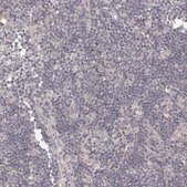 Anti-TACC2 antibody produced in rabbit Prestige Antibodies® Powered by Atlas Antibodies, affinity isolated antibody, buffered aqueous glycerol solution