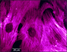 单克隆抗-肌动蛋白，α-平滑肌 clone 1A4, ascites fluid