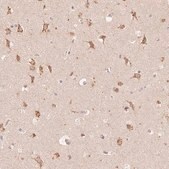 Anti-STK39 antibody produced in rabbit Prestige Antibodies® Powered by Atlas Antibodies, affinity isolated antibody, buffered aqueous glycerol solution