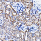 Anti-Prohibitin antibody produced in rabbit