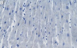 Anti-MLC-2/MYL2 Antibody, clone 19D3.1 ZooMAb® Mouse Monoclonal recombinant, expressed in HEK 293 cells