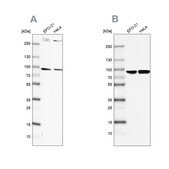Anti-RPAP3 antibody produced in rabbit Prestige Antibodies® Powered by Atlas Antibodies, affinity isolated antibody, buffered aqueous glycerol solution