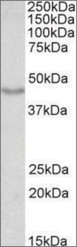 Anti-DCX antibody produced in goat affinity isolated antibody, buffered aqueous solution