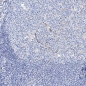 Anti-MAGI1 antibody produced in rabbit Prestige Antibodies® Powered by Atlas Antibodies, affinity isolated antibody, buffered aqueous glycerol solution, ab2